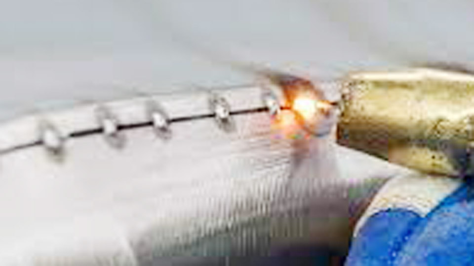 Close-up of MIG tack welds on a car’s sheet metal patch panel